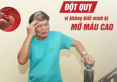 Risiko Stroke Akibat Kolesterol Tinggi: Apa yang Perlu Diketahui
