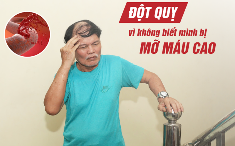 Risiko Stroke Akibat Kolesterol Tinggi: Apa yang Perlu Diketahui