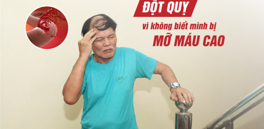 Risiko Stroke Akibat Kolesterol Tinggi: Apa yang Perlu Diketahui