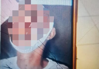 Polisi Tak Temukan Unsur Pidana dalam Kematian Taruna Poltekpel Malahayati, DBD Jadi Dugaan Medis