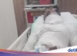 Sopir Truk di Bali Meninggal Setelah Diberi Luka Bakar Oleh Bos