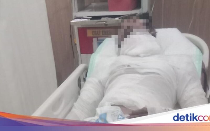 Sopir Truk di Bali Meninggal Setelah Diberi Luka Bakar Oleh Bos