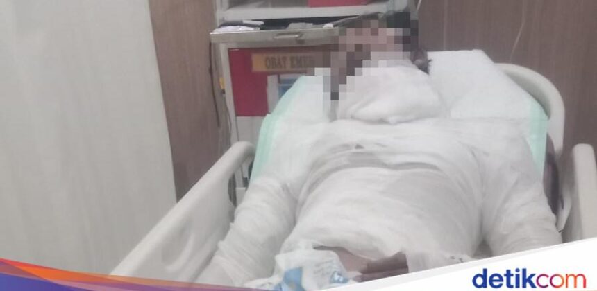 Sopir Truk di Bali Meninggal Setelah Diberi Luka Bakar Oleh Bos
